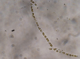 スケレトネマ・コスタツム